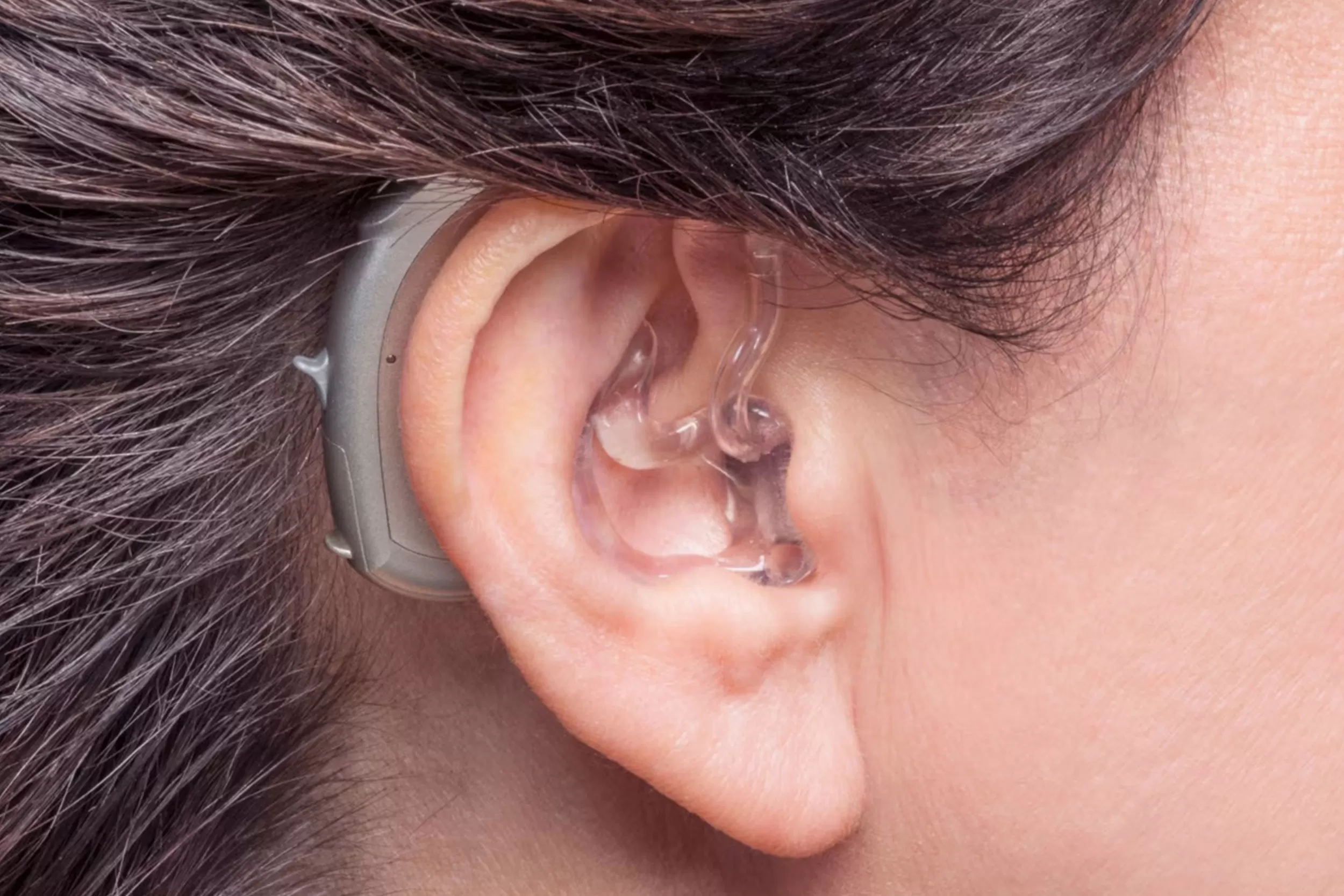 Kulak arkası işitme cihazı